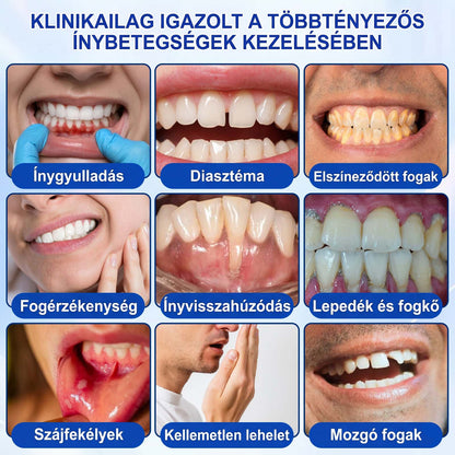 PureShade®👍🦷GumRevive Ínyregeneráló Gél – Az egészségesebb ínyért és magabiztosabb mosolyért 🦷