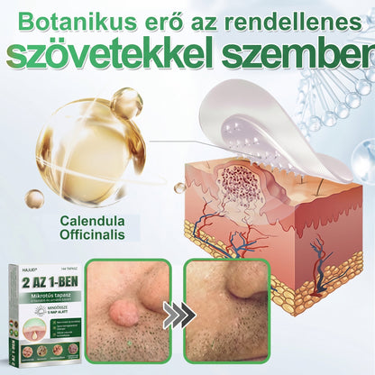 🇭🇺 HAJUEI® 2-az-1-ben Mikrotű & Hidrokoloid Tapasz | Láthatatlan Csillag Tapasz Bőrhibákra, Pattanásokra és Egyenetlen Bőrfelszínre | Arcra és Testre | 144 db ✨
