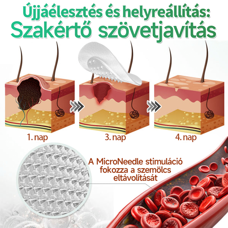 🇭🇺 HAJUEI® 2-az-1-ben Mikrotű & Hidrokoloid Tapasz | Láthatatlan Csillag Tapasz Bőrhibákra, Pattanásokra és Egyenetlen Bőrfelszínre | Arcra és Testre | 144 db ✨