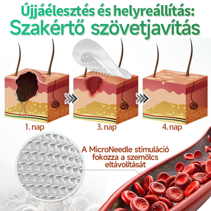 🇭🇺 HAJUEI® 2-az-1-ben Mikrotű & Hidrokoloid Tapasz | Láthatatlan Csillag Tapasz Bőrhibákra, Pattanásokra és Egyenetlen Bőrfelszínre | Arcra és Testre | 144 db ✨