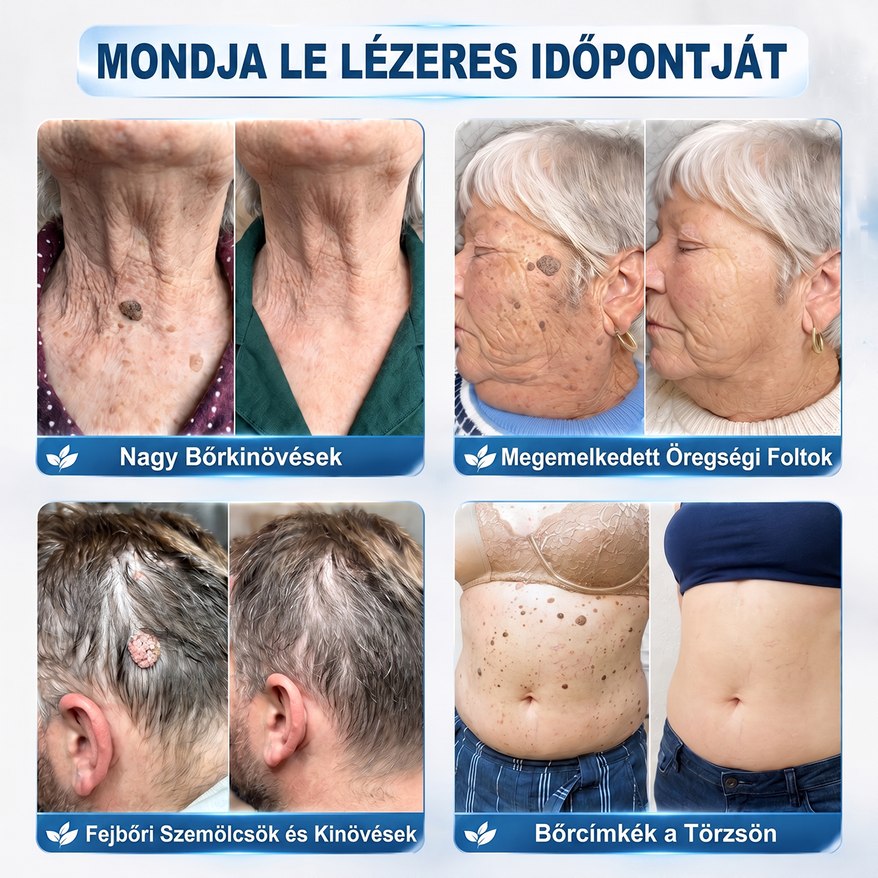 Hiskin®🎁Már csak 5 darab maradt! További 50% kedvezményt biztosítunk!✨ Szerezze be most prémium bőrápolási rutinjához, és ne hagyja ki ezt a különleges ajánlatot.⏰ Ez a kedvezmény csak korlátozott ideig érhető el!
