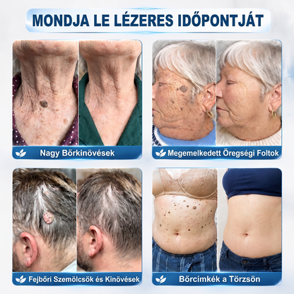 Hiskin®🎁Már csak 5 darab maradt! További 50% kedvezményt biztosítunk!✨ Szerezze be most prémium bőrápolási rutinjához, és ne hagyja ki ezt a különleges ajánlatot.⏰ Ez a kedvezmény csak korlátozott ideig érhető el!