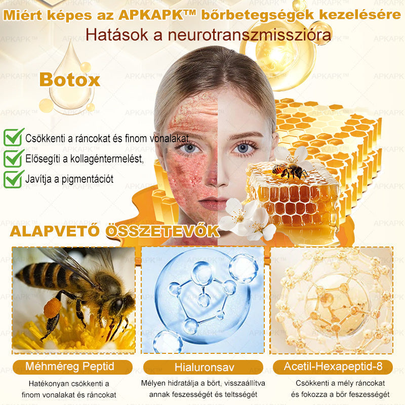 🐝🥇 𝖠𝖯𝖪𝖠𝖯𝖪® Méhméreg Bőr Helyreállító Krém 🔥 Magyar fejlesztés, magyarországi gyártás és szállítás