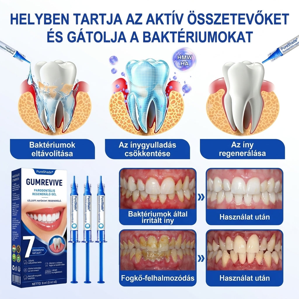 PureShade®👍🦷GumRevive Ínyregeneráló Gél – Az egészségesebb ínyért és magabiztosabb mosolyért 🦷
