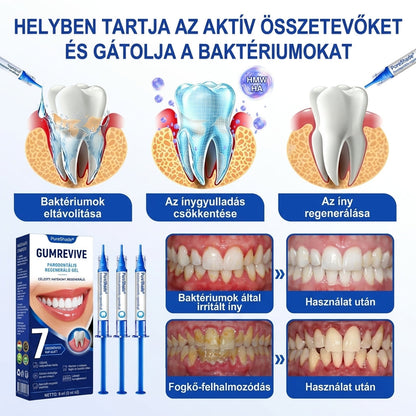 PureShade®👍🦷GumRevive Ínyregeneráló Gél – Az egészségesebb ínyért és magabiztosabb mosolyért 🦷