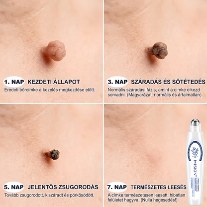 Hiskin®🎁Már csak 5 darab maradt! További 50% kedvezményt biztosítunk!✨ Szerezze be most prémium bőrápolási rutinjához, és ne hagyja ki ezt a különleges ajánlatot.⏰ Ez a kedvezmény csak korlátozott ideig érhető el!