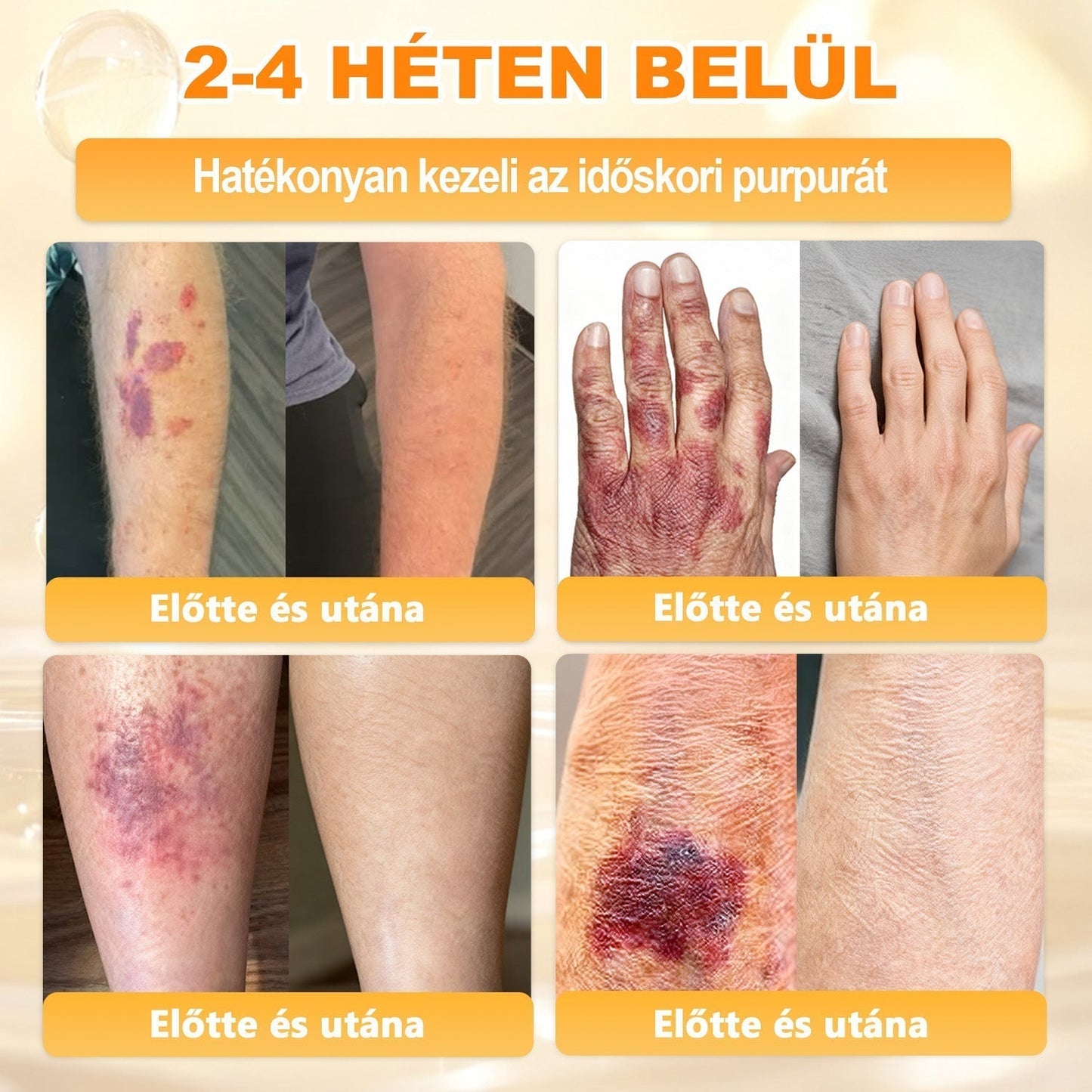 🐝🥇 𝖠𝖯𝖪𝖠𝖯𝖪® Méhméreg Bőr Helyreállító Krém 🔥 Magyar fejlesztés, magyarországi gyártás és szállítás