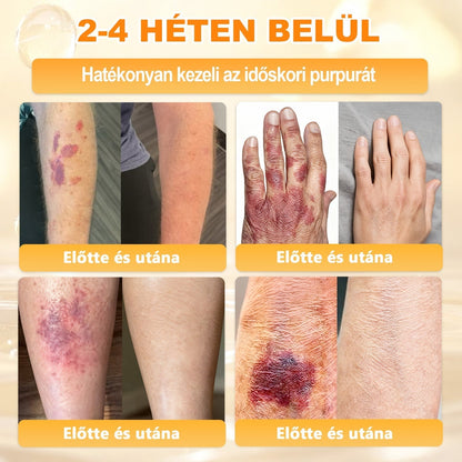 🐝🥇 𝖠𝖯𝖪𝖠𝖯𝖪® Méhméreg Bőr Helyreállító Krém 🔥 Magyar fejlesztés, magyarországi gyártás és szállítás