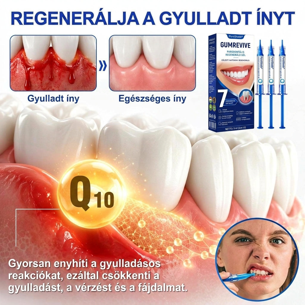 PureShade®👍🦷GumRevive Ínyregeneráló Gél – Az egészségesebb ínyért és magabiztosabb mosolyért 🦷