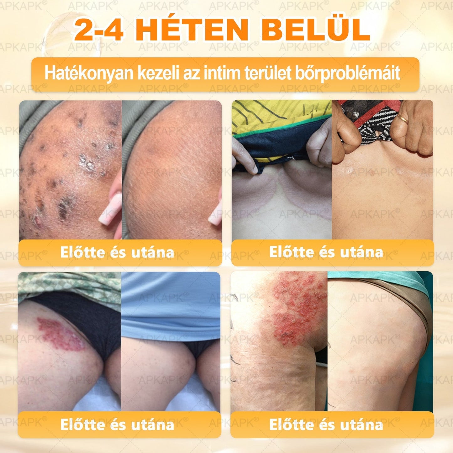 APKAPK® Méhméreges Bőrregeneráló & Feszesítő Krém– Prémium Anti-Aging Ápolás Érett és Érzékeny Bőrre