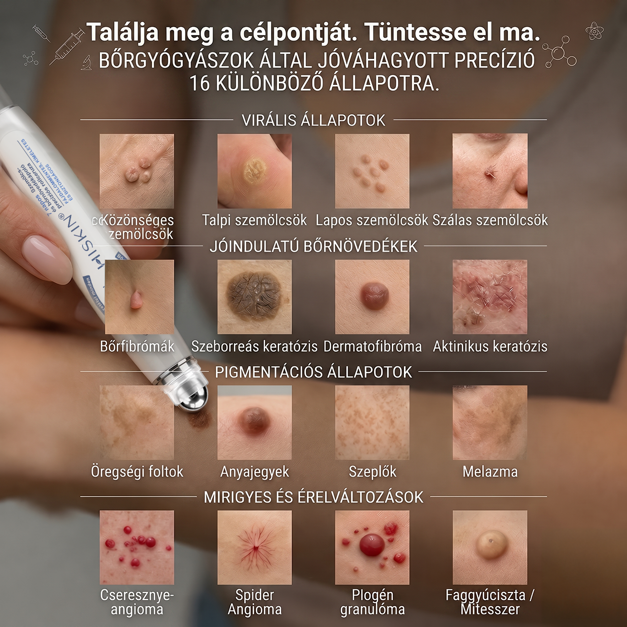 Hiskin®🎁Már csak 5 darab maradt! További 50% kedvezményt biztosítunk!✨ Szerezze be most prémium bőrápolási rutinjához, és ne hagyja ki ezt a különleges ajánlatot.⏰ Ez a kedvezmény csak korlátozott ideig érhető el!