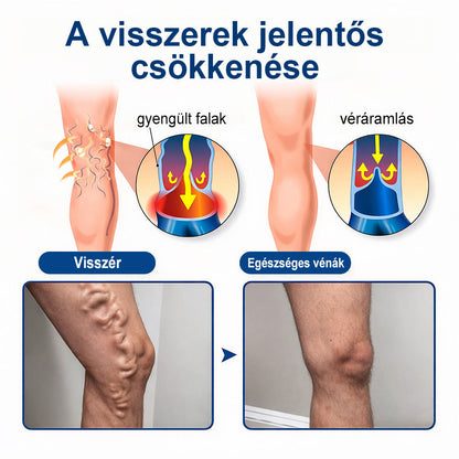 ✨🧑‍⚕️  FFBSI® Visszérápoló Mikrotűs Gondozó Tapasz ⚡ Azonnali Megkönnyebbülés, Hosszú Távú Eredmények