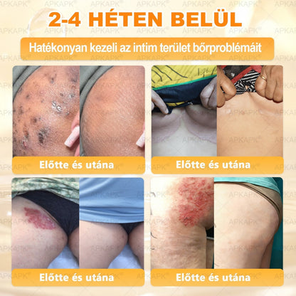 🐝🥇 𝖠𝖯𝖪𝖠𝖯𝖪® Méhméreg Bőr Helyreállító Krém 🔥 Magyar fejlesztés, magyarországi gyártás és szállítás