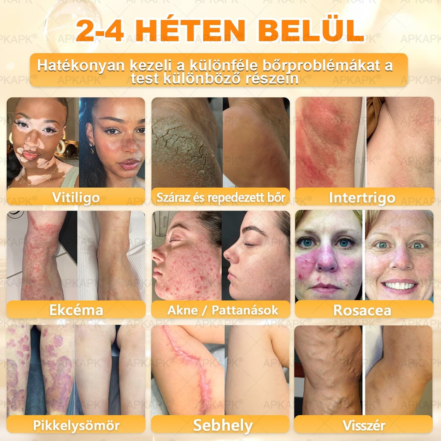 APKAPK® Méhméreges Bőrregeneráló & Feszesítő Krém– Prémium Anti-Aging Ápolás Érett és Érzékeny Bőrre