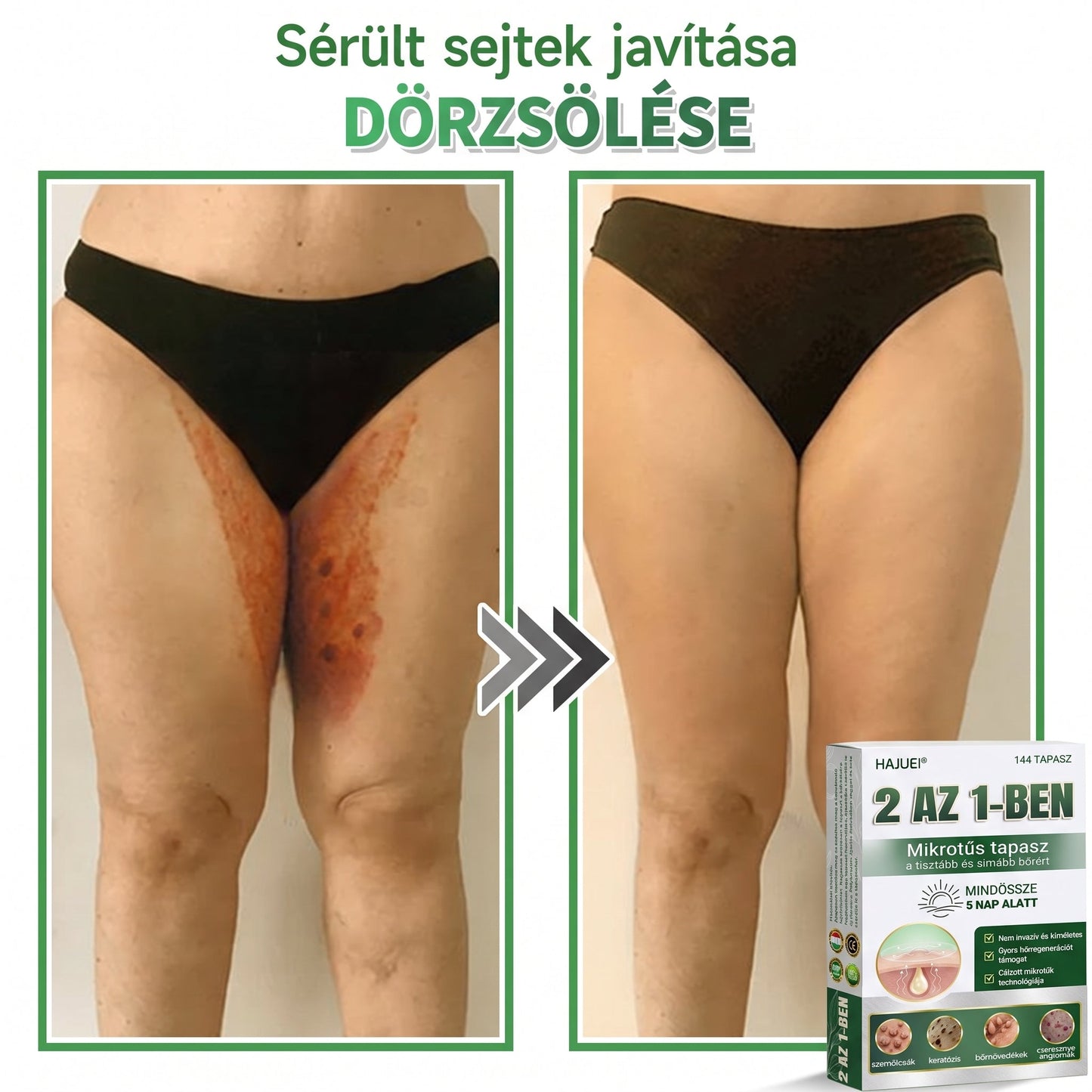 🇭🇺 HAJUEI® 2-az-1-ben Mikrotű & Hidrokoloid Tapasz | Láthatatlan Csillag Tapasz Bőrhibákra, Pattanásokra és Egyenetlen Bőrfelszínre | Arcra és Testre | 144 db ✨