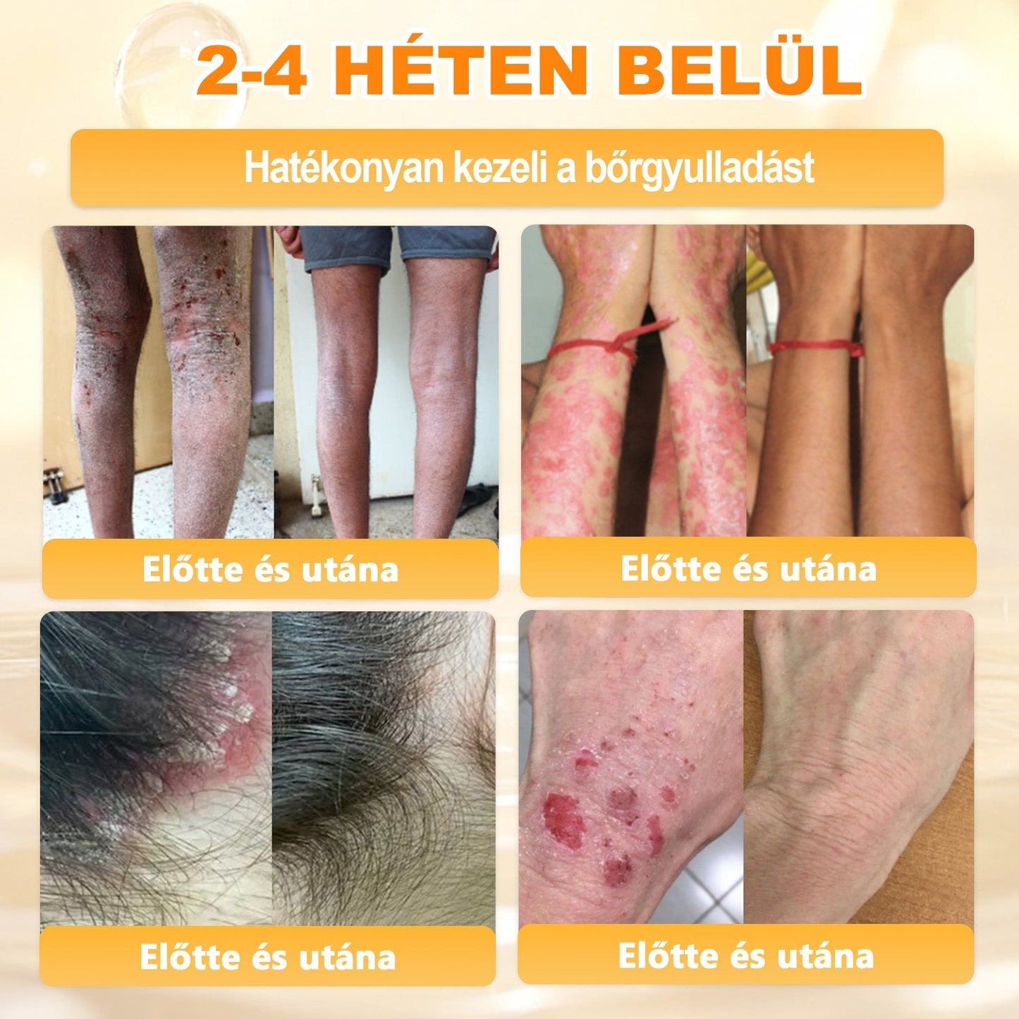 APKAPK® Méhméreges Bőrregeneráló & Feszesítő Krém– Prémium Anti-Aging Ápolás Érett és Érzékeny Bőrre