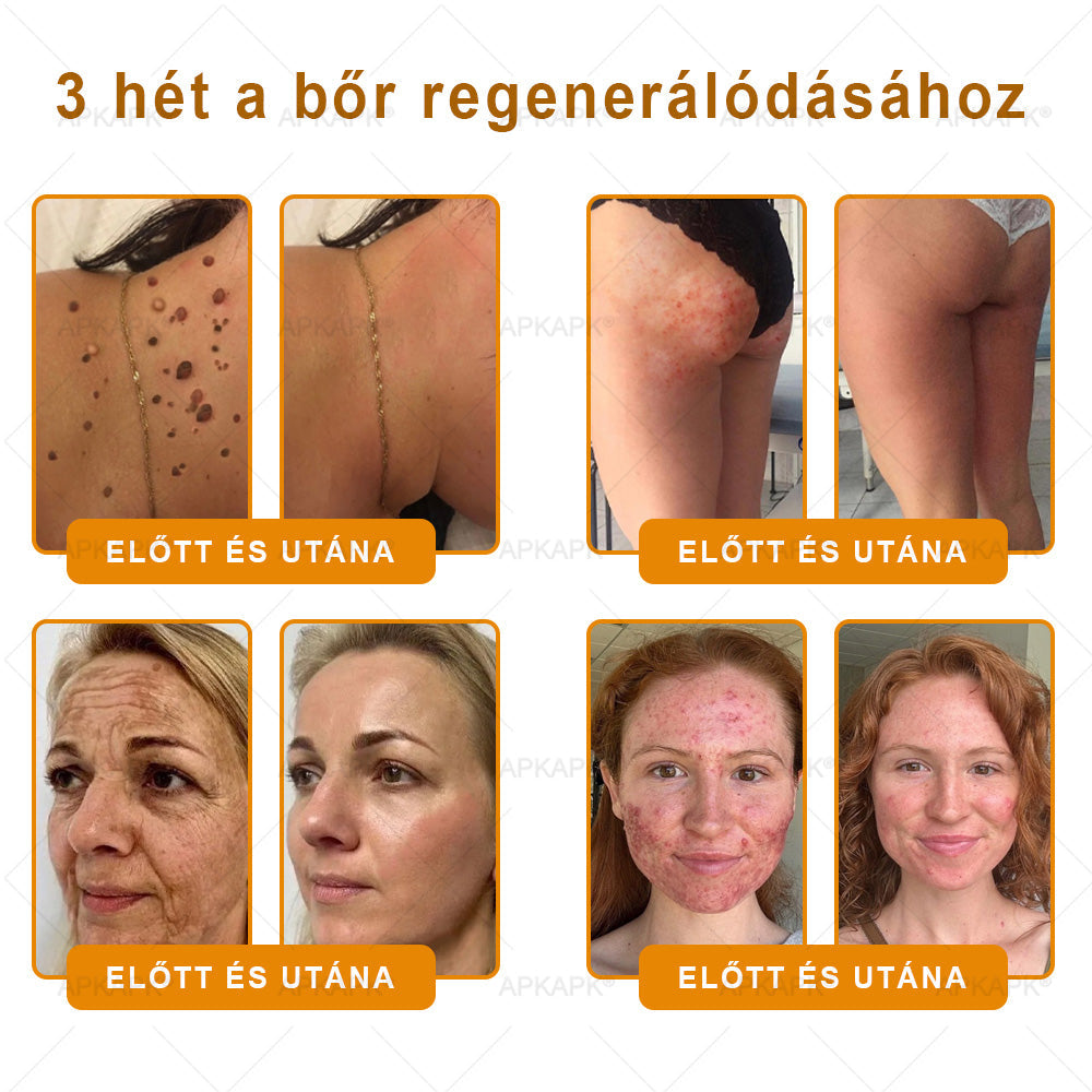 APKAPK® Méhméreges Bőrregeneráló & Feszesítő Krém– Prémium Anti-Aging Ápolás Érett és Érzékeny Bőrre