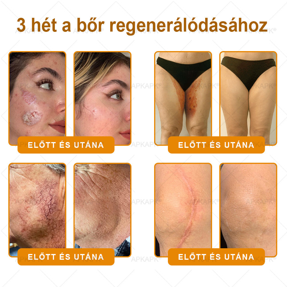 APKAPK® Méhméreges Bőrregeneráló & Feszesítő Krém– Prémium Anti-Aging Ápolás Érett és Érzékeny Bőrre