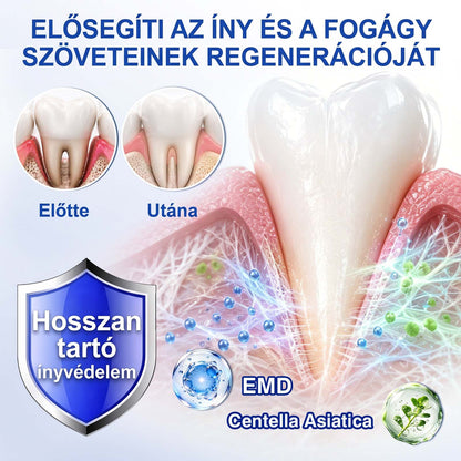 PureShade®👍🦷GumRevive Ínyregeneráló Gél – Az egészségesebb ínyért és magabiztosabb mosolyért 🦷