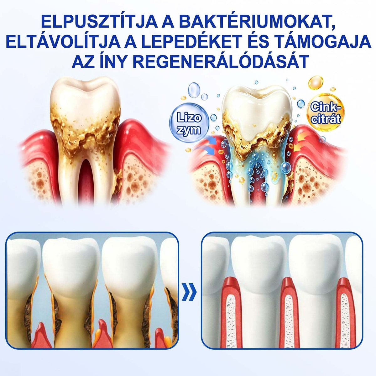 PureShade®👍🦷GumRevive Ínyregeneráló Gél – Az egészségesebb ínyért és magabiztosabb mosolyért 🦷