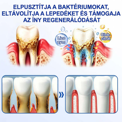 PureShade®👍🦷GumRevive Ínyregeneráló Gél – Az egészségesebb ínyért és magabiztosabb mosolyért 🦷