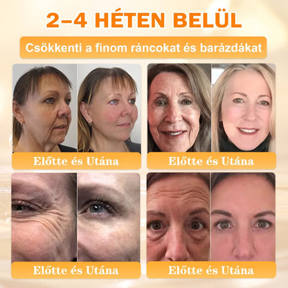 🐝🥇 𝖠𝖯𝖪𝖠𝖯𝖪® Méhméreg Bőr Helyreállító Krém 🔥 Magyar fejlesztés, magyarországi gyártás és szállítás