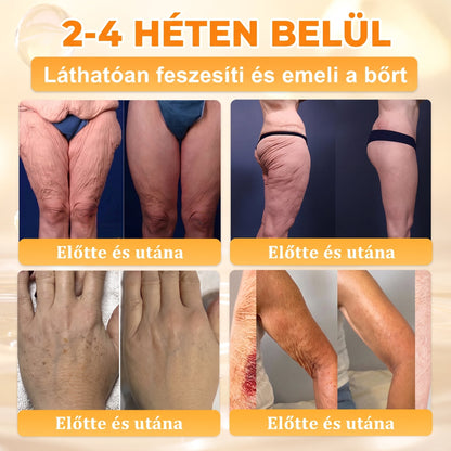 🐝🥇 𝖠𝖯𝖪𝖠𝖯𝖪® Méhméreg Bőr Helyreállító Krém 🔥 Magyar fejlesztés, magyarországi gyártás és szállítás